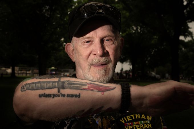 Man in black vest showing right forearm